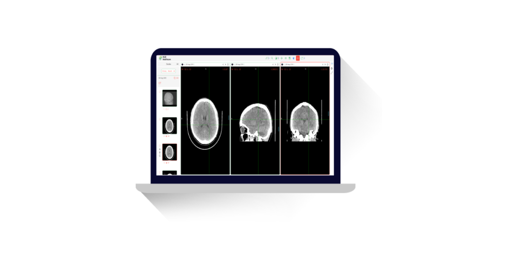 Infographic displaying MRI usage statistics with images from the HUB Healthcare platform, showcasing free access to DICOM-compliant imaging, healthcare communication, medical imaging, healthcare analytics, and care coordination.