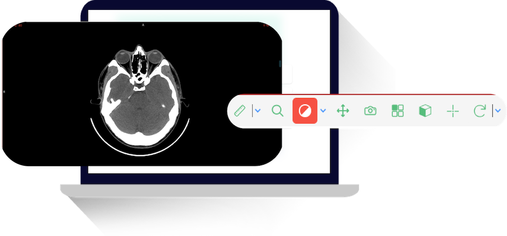 Infographic highlighting the benefits of MRI scanning with HUB Healthcare images, focusing on DICOM standards, free resources for healthcare providers, healthcare analytics, patient management software, integrated healthcare, and medical imaging