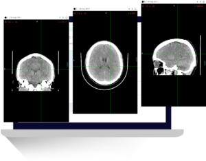 MRI images times three