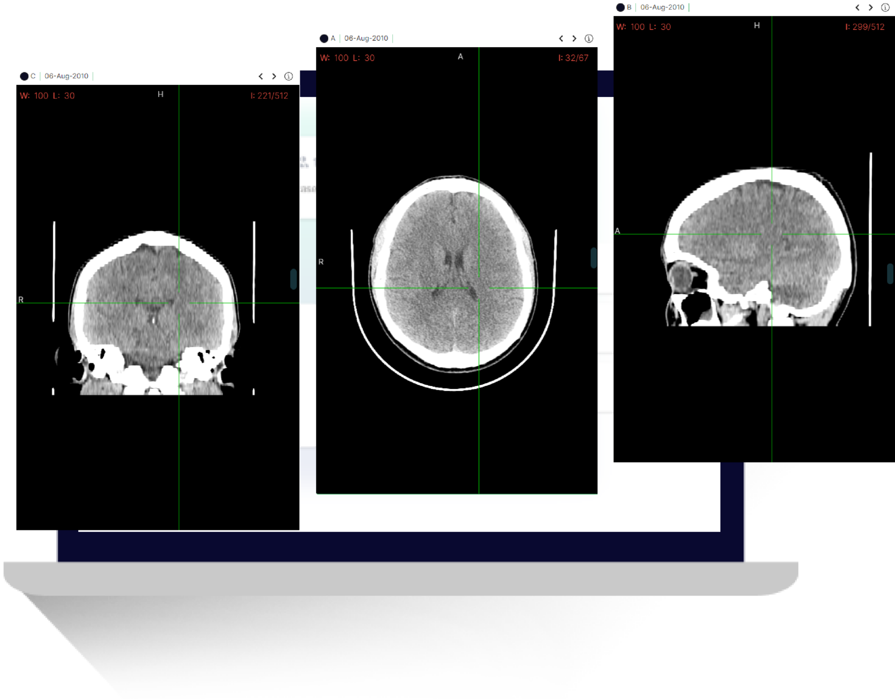 how-will-ai-shape-the-future-of-radiology-hub-healthcare