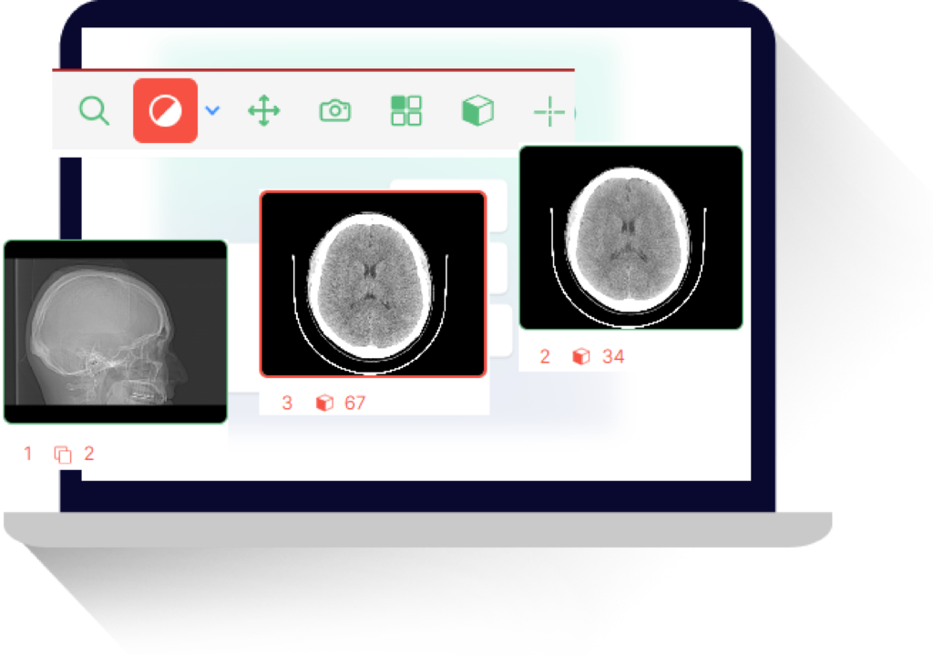 Dicom Viewer